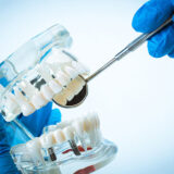 Tipos prótesis dentales y cuidados