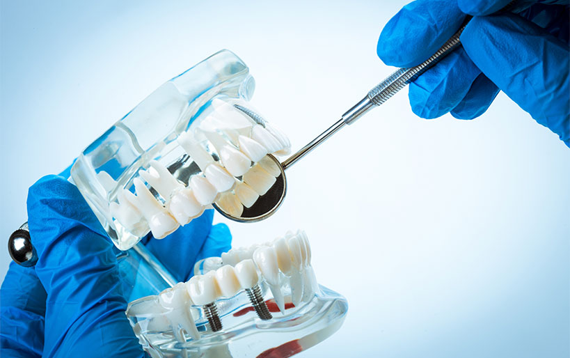 Tipos prótesis dentales y cuidados